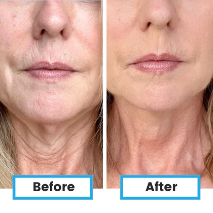 NutriSwish suteikia švarią energiją