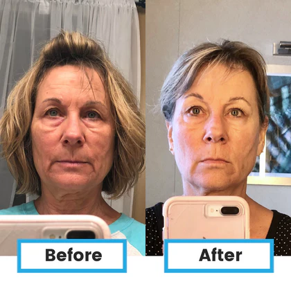 Neumi Skin drėkina ir šviesina odą