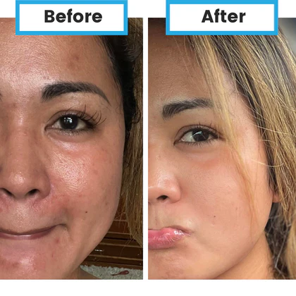 Neumi Neuro padeda susikaupti ir gerina atmintį