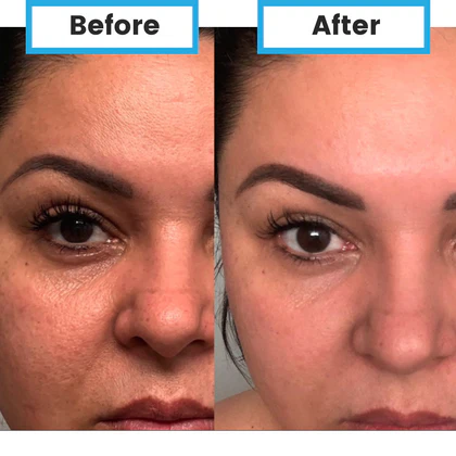 Neumi Hair stiprina plaukus ir skatina augimą